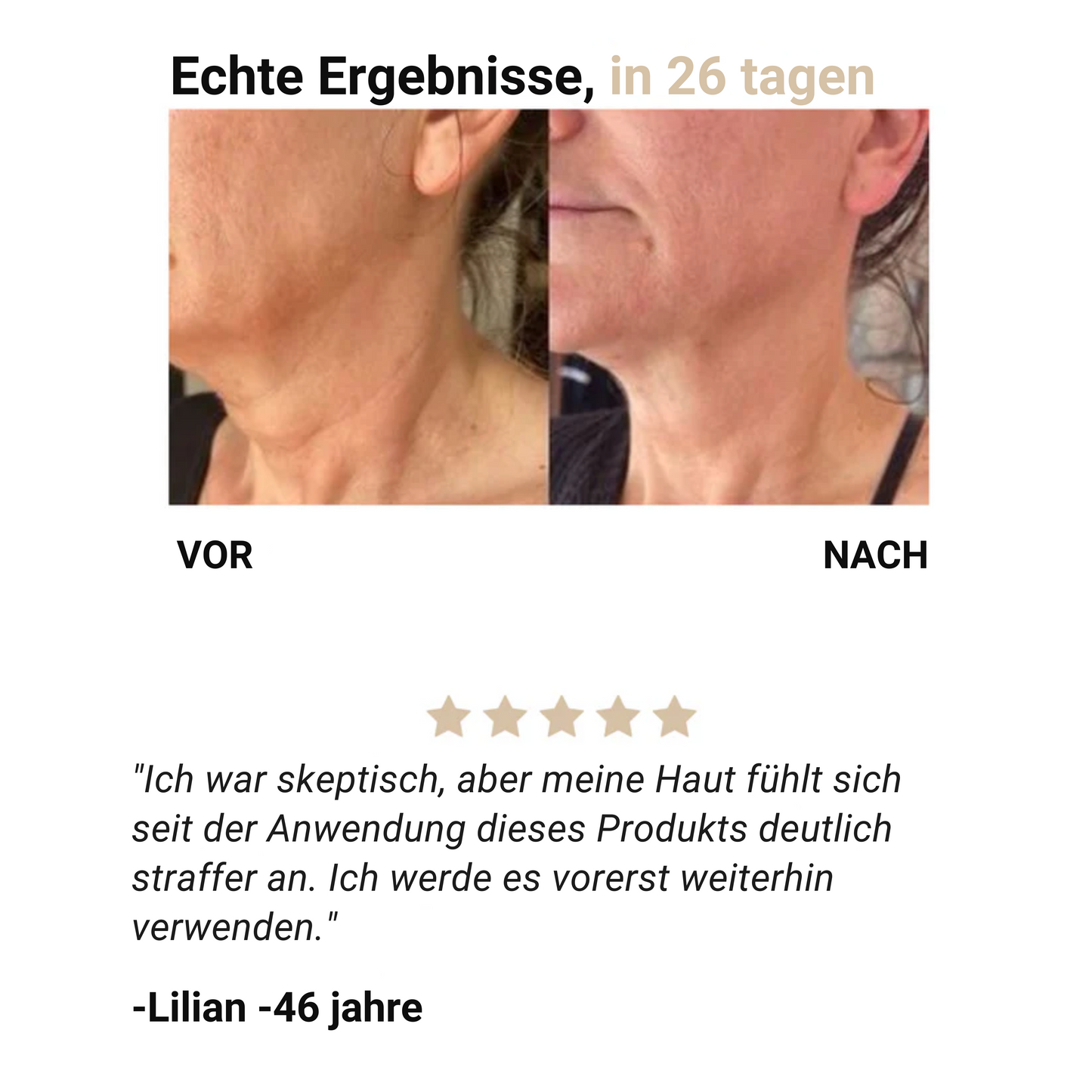 Firming – Straffende Creme für den Hals