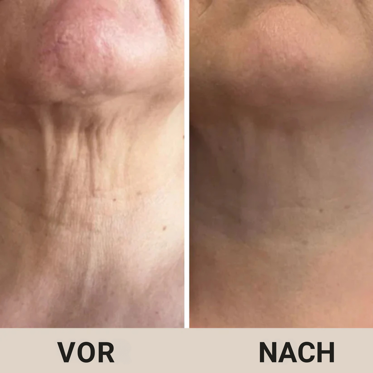 Firming – Straffende Creme für den Hals