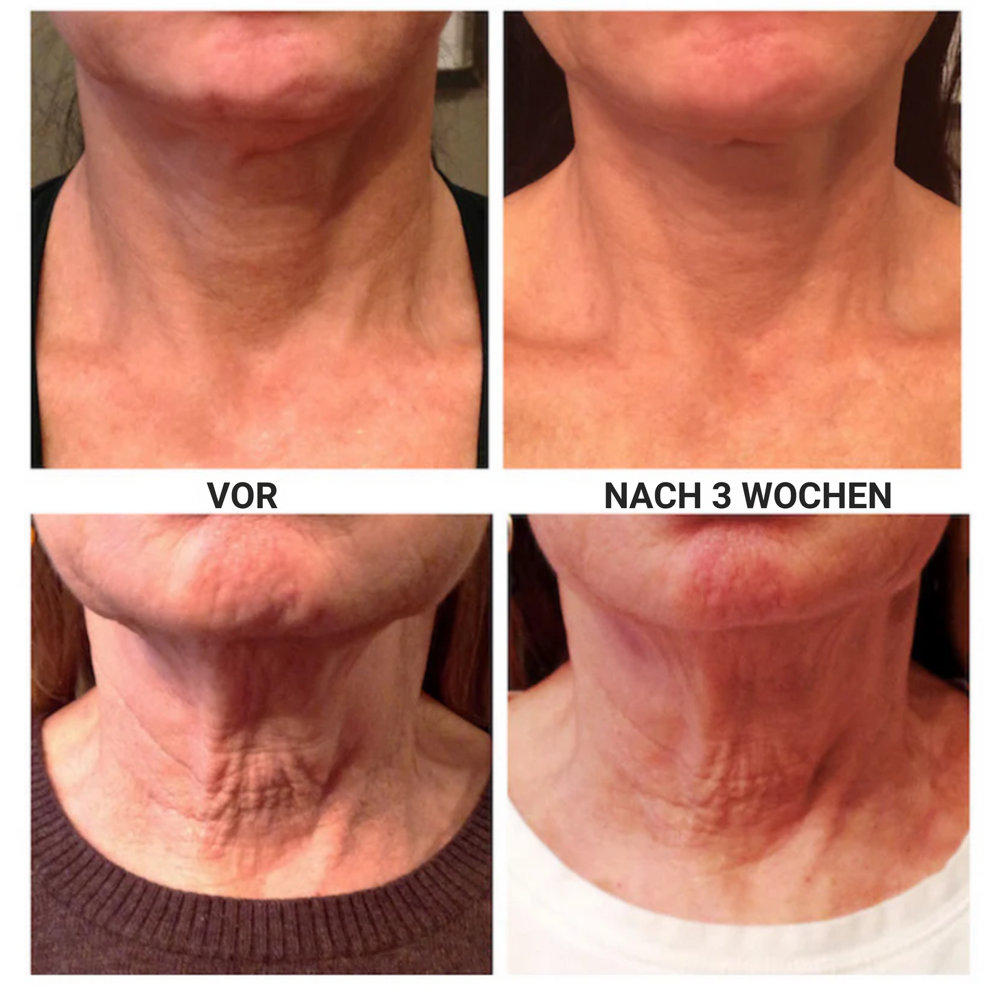 Firming – Straffende Creme für den Hals