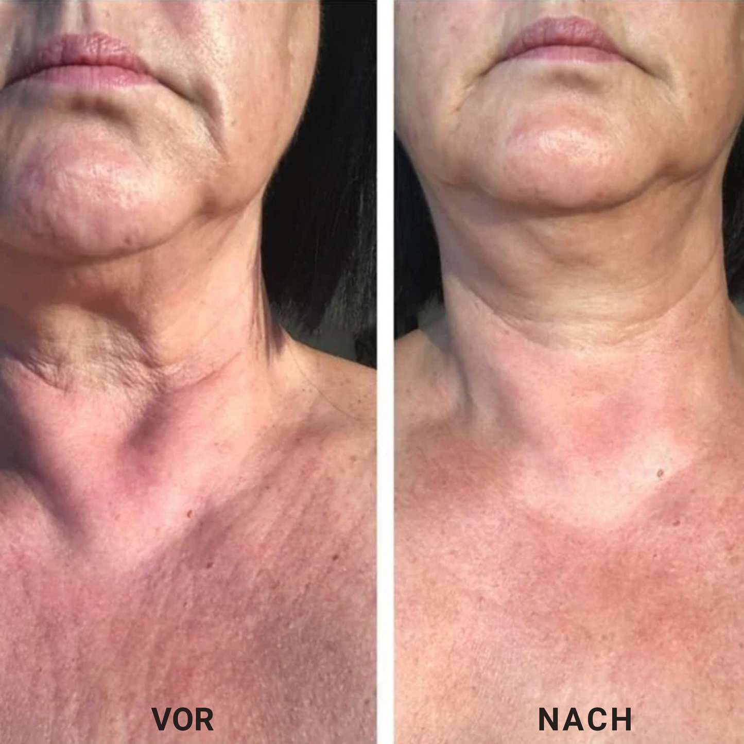 Firming – Straffende Creme für den Hals