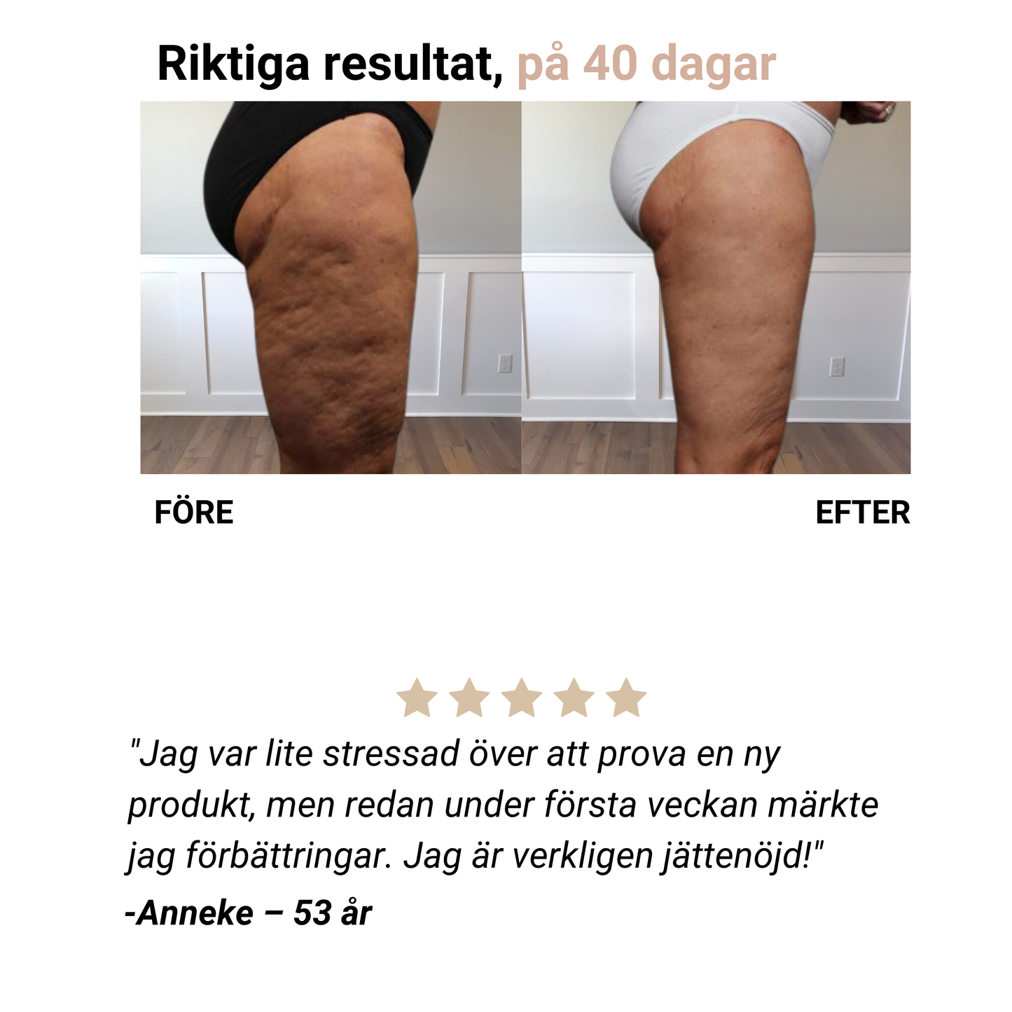 Selena® – Anti-Cellulit-Massager för slät hud