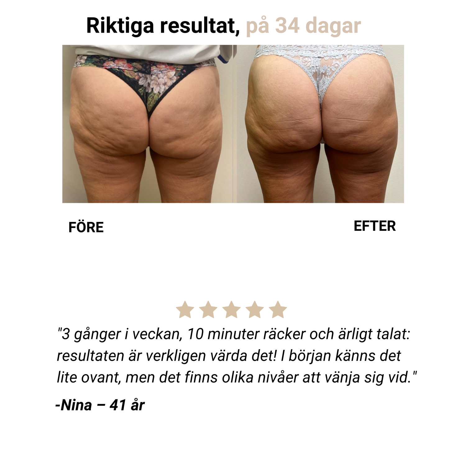 Selena® – Anti-Cellulit-Massager för slät hud