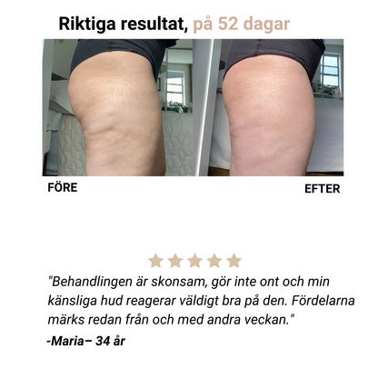Selena® – Anti-Cellulit-Massager för slät hud