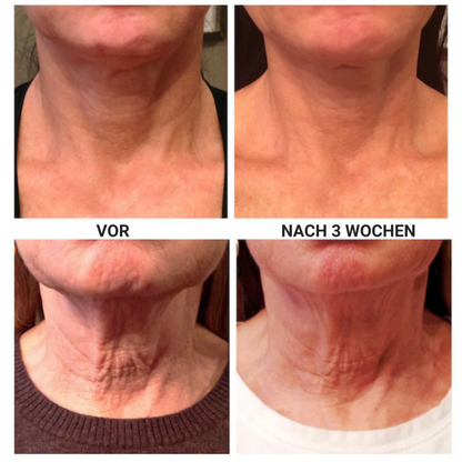 Firming – Straffende Creme für den Hals